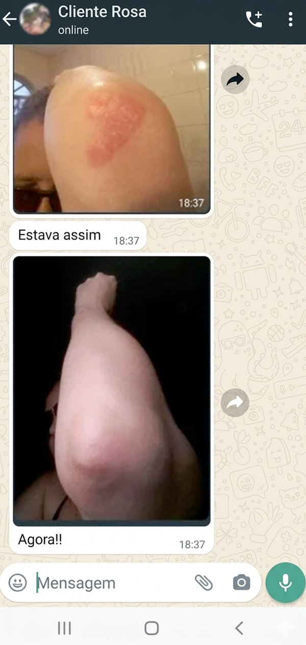 ✔️ resultado positivo após uso