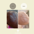 Creme reestruturante Neodermax [1 ind]